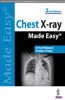 Chest X-ray Made Easy