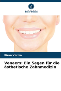 Veneers