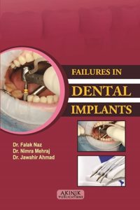 Failures in Dental Implants (ISBN No. 978-93-5570-700-0)