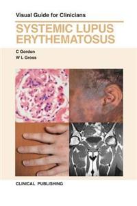 Systemic Lupus Erythemus: Visual Guide for Clinicians