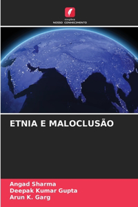 Etnia E Maloclusão