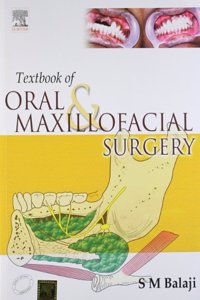 Textbook of Oral & Maxillofacial Surgery