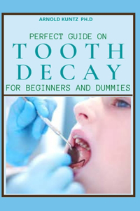 Perfect Guide on Tooth Decay for Beginners and Dummies
