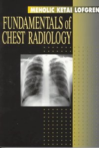 Fundamentals of Chest Radiology (Fundamentals of Radiology)