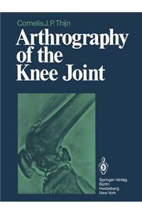 Arthrography of the Knee Joint