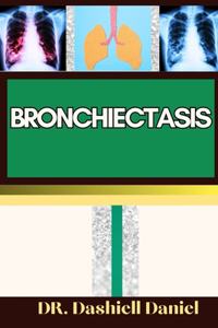 Bronchiectasis