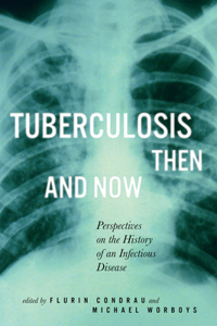 Tuberculosis Then and Now