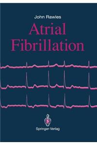 Atrial Fibrillation