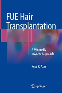 Fue Hair Transplantation