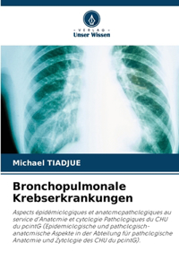 Bronchopulmonale Krebserkrankungen