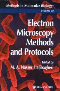 Electron Microscopy Methods and Protocols. Methods in Molecular Biology, Volume 117