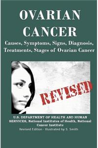 Ovarian Cancer