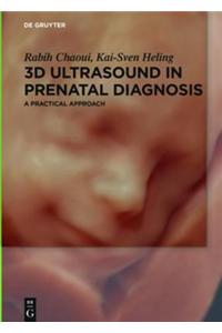 3D Ultrasound in Prenatal Diagnosis