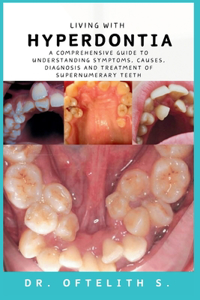 Living with Hyperdontia