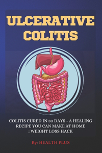 Ulcerative Colitis