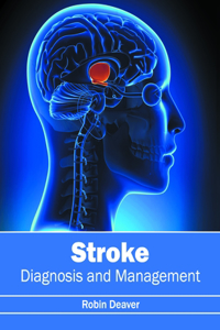 Stroke: Diagnosis and Management