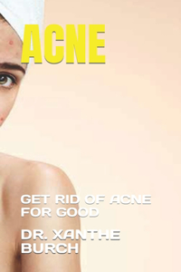Acne