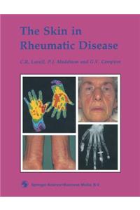 Skin in Rheumatic Disease