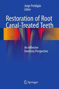 Restoration of Root Canal-Treated Teeth