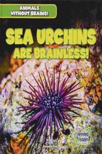 Sea Urchins Are Brainless!