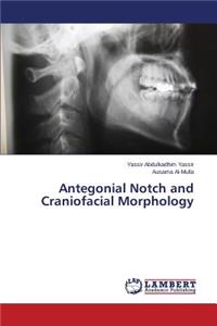 Antegonial Notch and Craniofacial Morphology