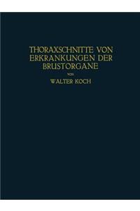 Thoraxschnitte Von Erkrankungen Der Brustorgane