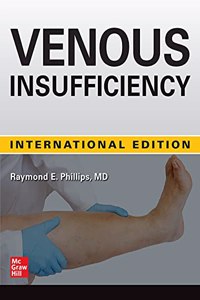 Venous Insufficiency