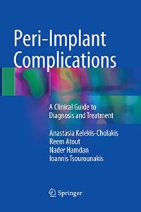 Peri-Implant Complications