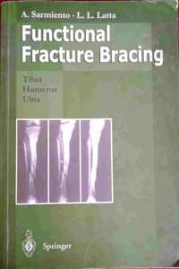 Functional Fracture Bracing Dm 388.00