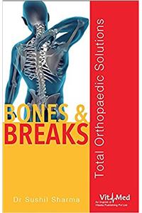 Bones and Breaks