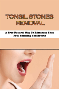 Tonsil Stones Removal