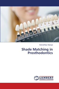 Shade Matching in Prosthodontics