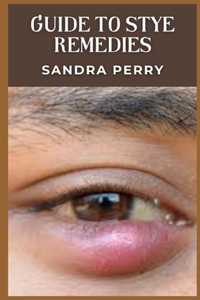 Guide to Stye Remedies
