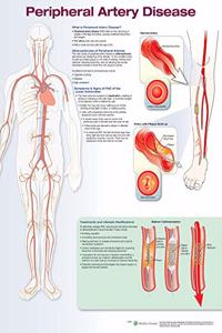 Peripheral Artery Disease