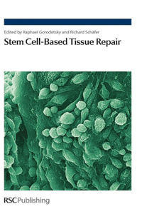 Stem Cell-Based Tissue Repair