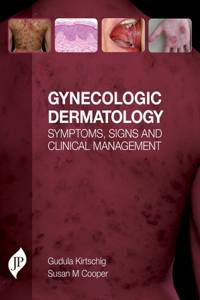 Gynecologic Dermatology