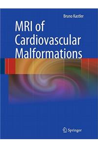 MRI of Cardiovascular Malformations