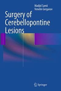 Surgery of Cerebellopontine Lesions