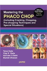 Mastering the Nucleotomy Techniques in Phaco (with 4 DVD-ROMs)
