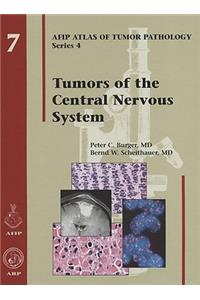 Tumors of the Central Nervous System