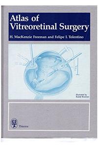 Atlas of Vitreoretinal Surgery