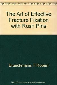 The Art of Effective Fracture Fixation with Rush Pins