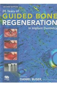 20 Years of Guided Bone Regeneration in Implant Dentistry