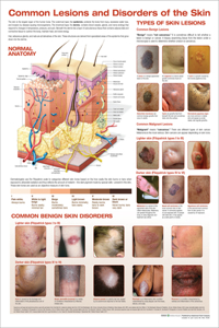 Common Lesions and Disorders of the Skin Anatomical Chart