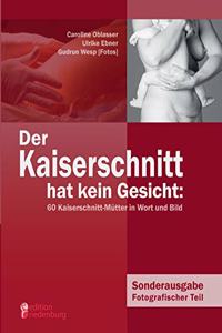 Kaiserschnitt hat kein Gesicht