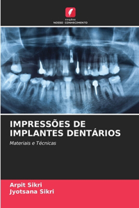 Impressões de Implantes Dentários