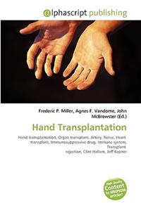 Hand Transplantation