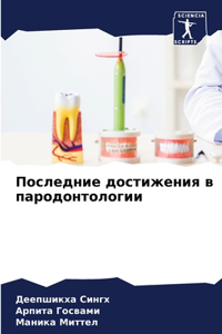 Последние достижения в пародонтологии