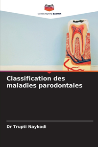 Classification des maladies parodontales