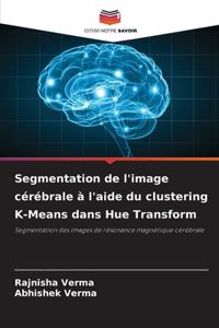 Segmentation de l'image cérébrale à l'aide du clustering K-Means dans Hue Transform